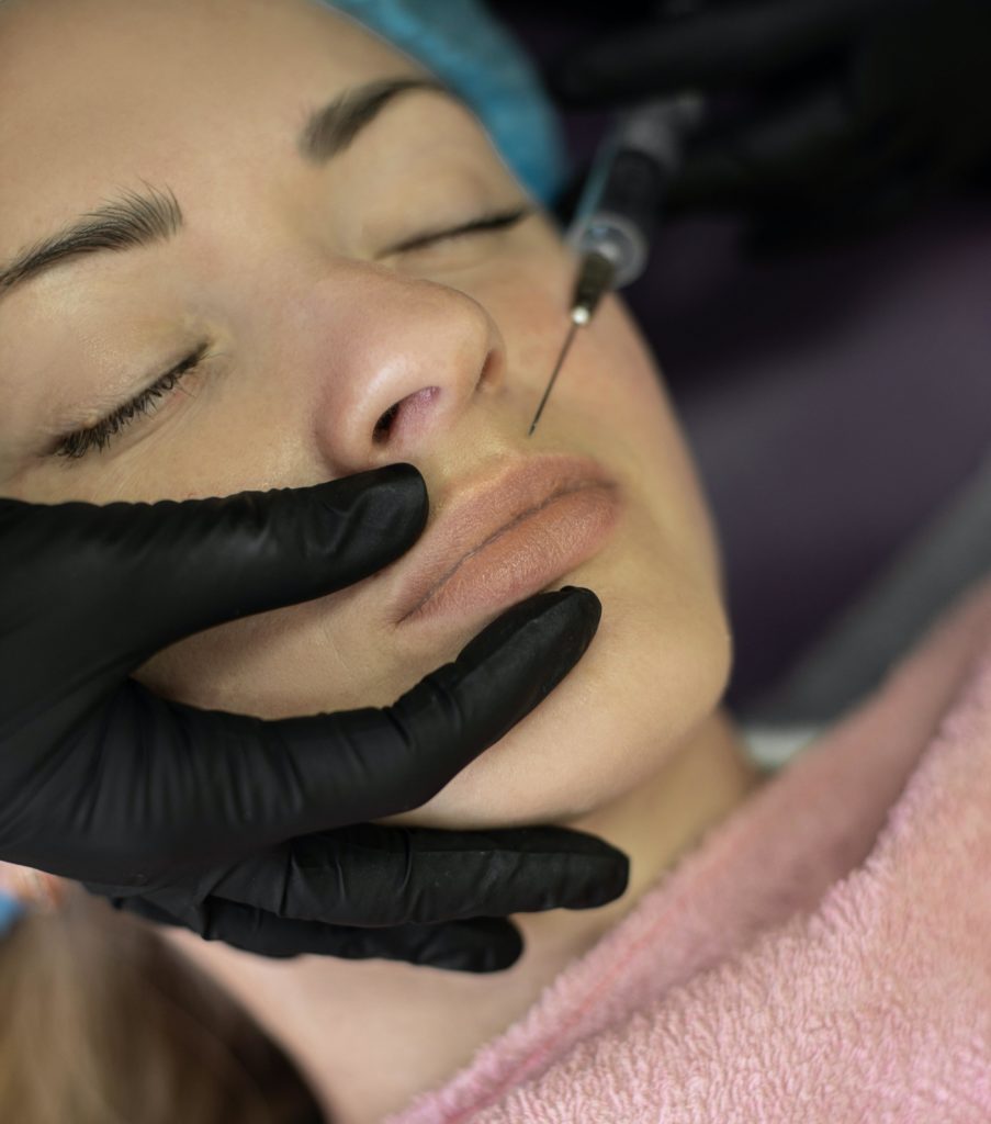 Ácido hialurónico periocular Ojeras Barcelona