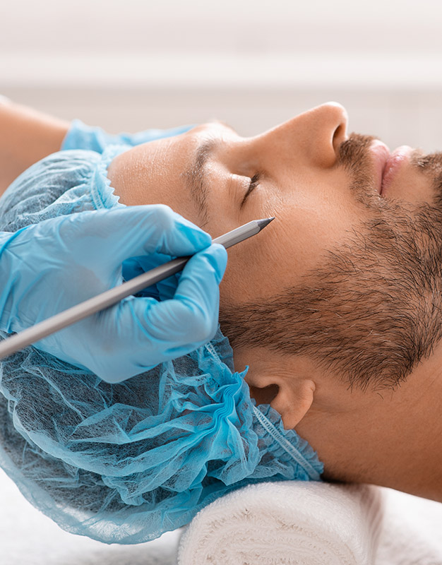 Blefaroplastia cirugía de párpados Barcelona